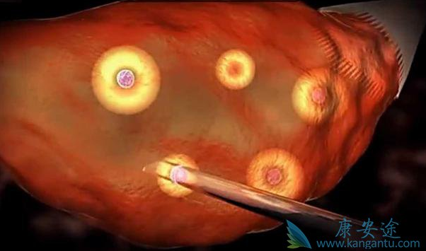 1523260432457083.png blob.png