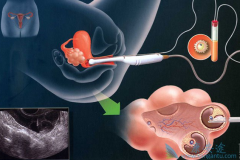 �Թ�Ӥ����ֲ��ע����������������