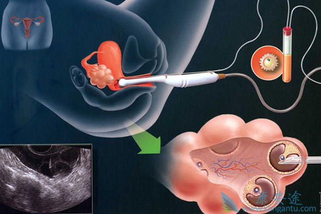 1523260848198204.png blob.png