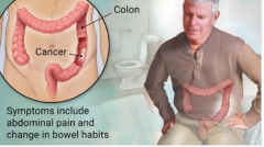 ���ڴ󳦰�֢״����ֱ�Ѫ��֢״