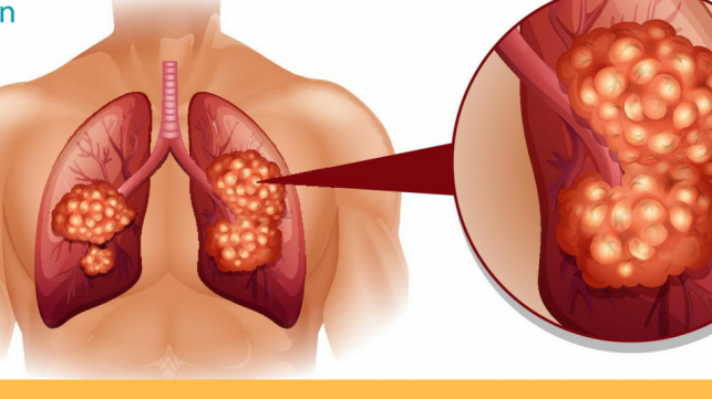 Ԥ���ΰ�����