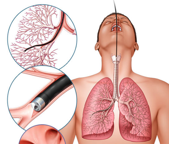 Ԥ���ΰ�����