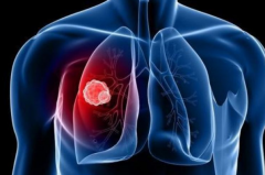 ��������ƥ����������ɼ�����Ʒΰ�Ч����ô��