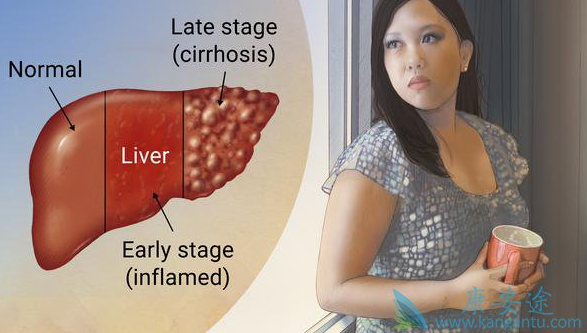 1523351332606231.png blob.png