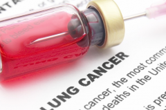 �ΰ����ڻ���ʱ���ע������