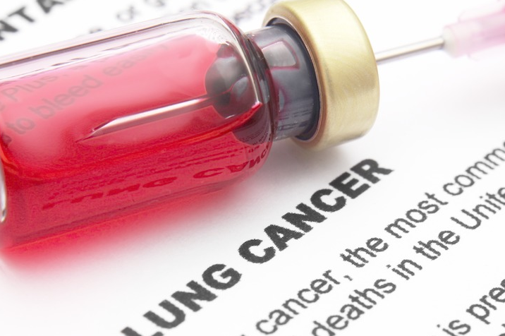 肺癌晚期化疗 肺癌晚期化疗