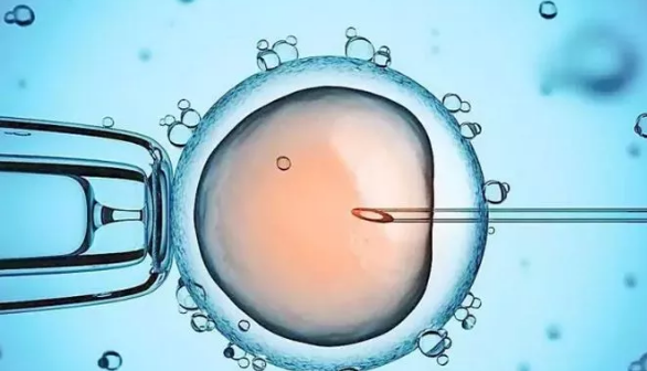 1523436173354237.png blob.png