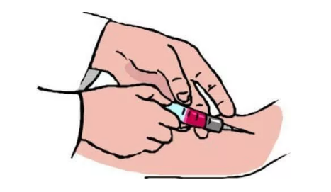 丙肝是什么 丙肝是什么