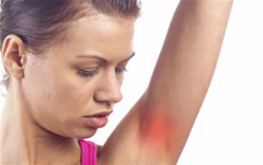 ����Ƥ����֢״��ţƤѢ��Ƥ�������