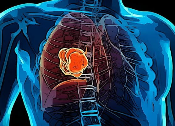 �ΰ���ת��֢״