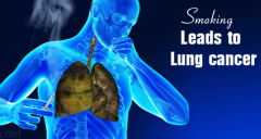 �����Ʒ������µķ�Сϸ���ΰ������Ʒ���