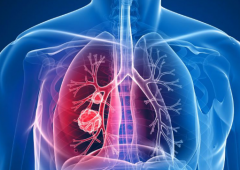 ���߷�չ���˷ΰ����ڻᴫȾ��