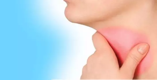 1523523201647800.png blob.png