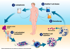 ����CAR-T�Ʒ�Kymriah��Yescarta������������