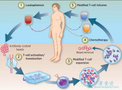 Kymriah��FDA��ȷ����Ϊ��ϸ������Ϊ�����Ļ������Ʋ�Ʒ