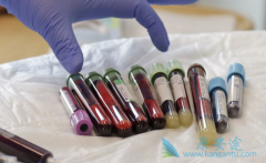 CAR-Tϸ���Ʒ������ɿ������䷽ʽ