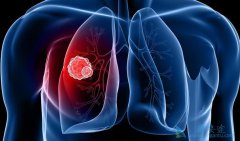 �������Ի���ͻ��ķΰ������Ʒ�������Щ