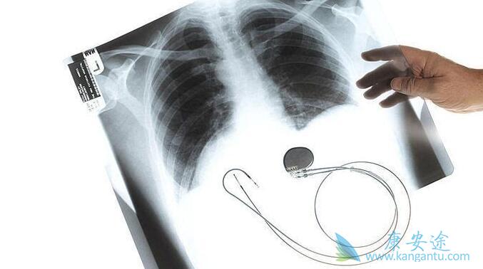 �ΰ���ת�Ʒ���