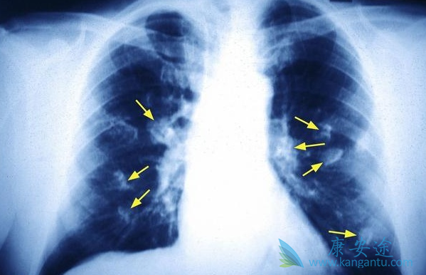 �ΰ����ڵ�֢״