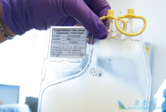 ŵ������������CAR-T�Ʒ�Kymirah�ĳ�����ý��