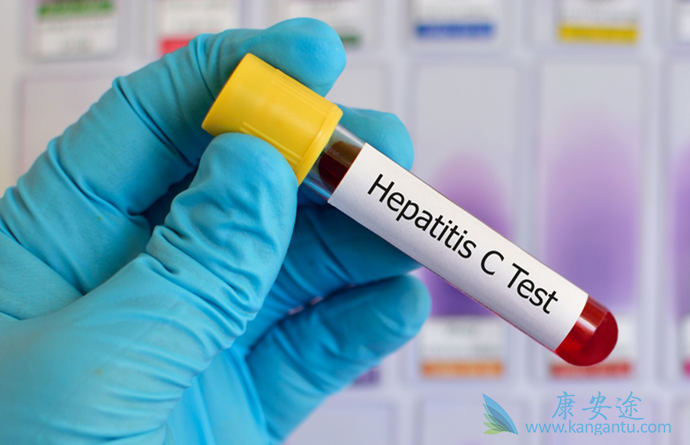 丙肝怎么传染的 丙肝怎么传染的