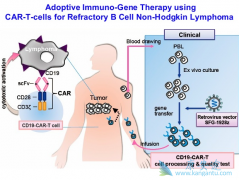 ��һ������CAR-T���ٴ��о�Ϊ����HER2��CAR-T�Ʒ�