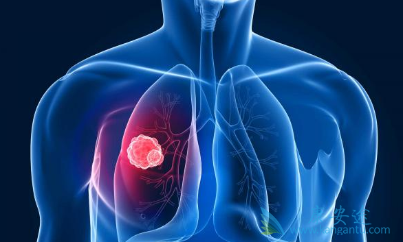 伽马刀治疗肺癌 伽马刀治疗肺癌