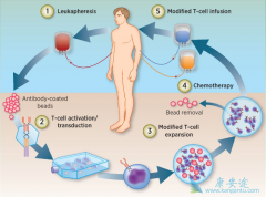 ����ͼ��ͯҽԺ��Seattle Children's Hospital��������һ��ȫ�µ�CAR-T�Ʒ�����