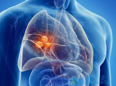 һ����ɼ�����Ʒΰ��нϳ�PFS�Ļ��߶����ѴӶ��������л���