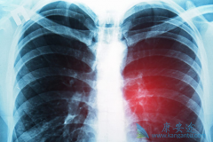 �ΰ���õ����Ʒ�������ݲ��鷢չ�����ı�