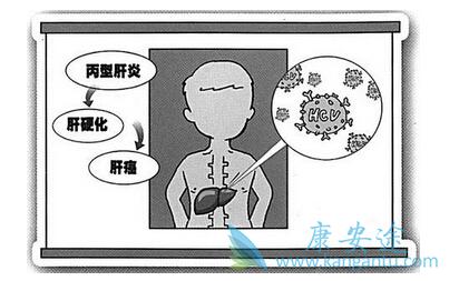丙肝的危害 丙肝的危害