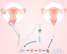 ��̥��˫��̥���Թ�Ӥ��������һ������