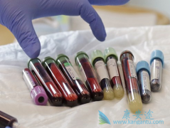 GSK�������ڿ�������TCAR-Tϸ�����Ʒ���