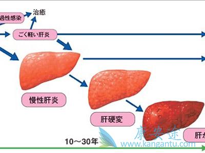 丙肝窗口期 丙肝窗口期