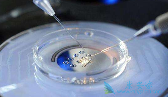 试管婴儿移植后反应 试管婴儿移植后反应