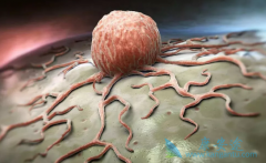 ��ͥ��֢Ԥ������������Щ��Ҫע���?