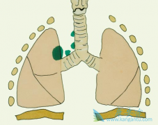 һ�����ж�����ΰ�����Ϊ�ΰ��ᴫȾ��?