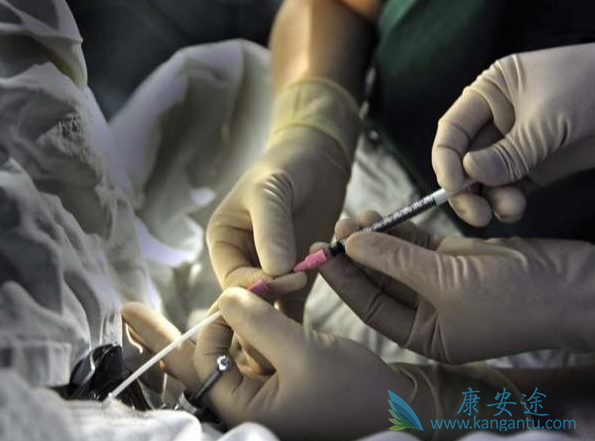 试管婴儿移植后腹痛 试管婴儿移植后腹痛