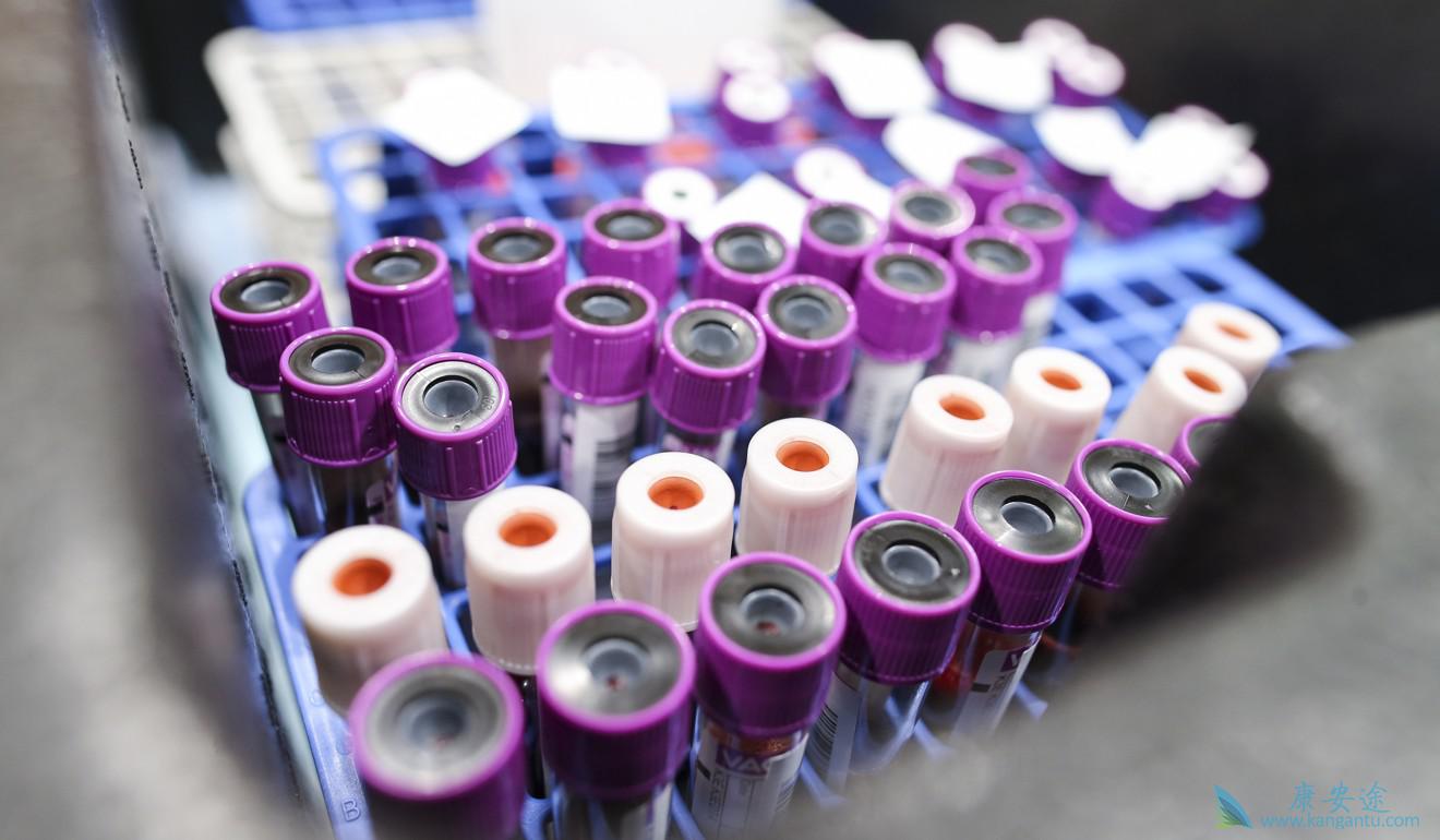 乙肝疫苗注意事项 乙肝疫苗注意事项