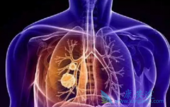 �˽����ڵķΰ�֢״�����ڼ����˺�