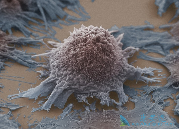 癌症肿瘤 癌症肿瘤