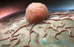 �����˸�����ת�Ƶİ�֢֢״����Щ?