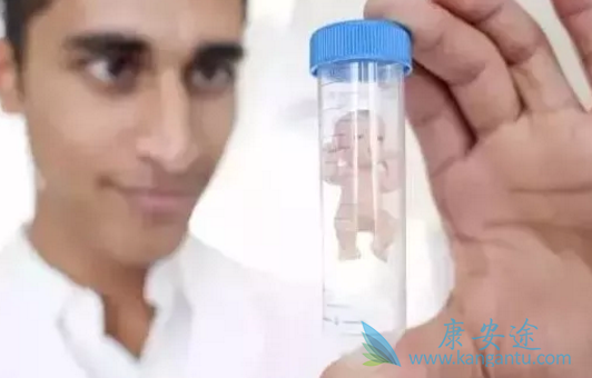 试管婴儿移植前注意事项 试管婴儿移植前注意事项