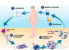 ��ͳ��CAR-T�Ʒ���һ�������ض����߼��ض����Ͱ�ϸ���ķ���