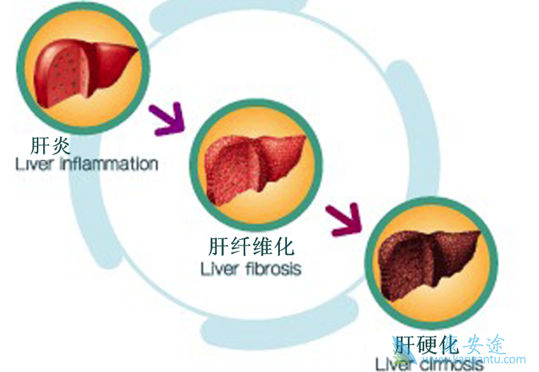 乙肝患者 乙肝患者