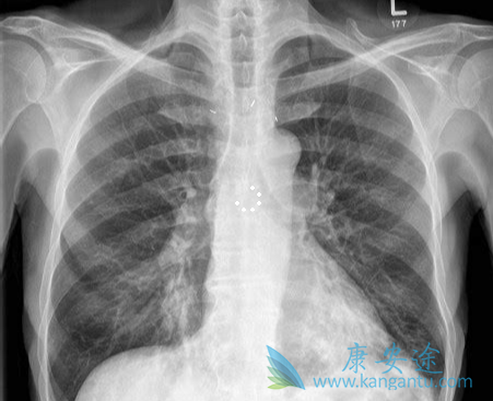 Сϸ���ΰ�������