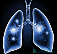 �ΰ������ܻ��ø����Ʒΰ��ķ����кܴ�Ĺ�ϵ