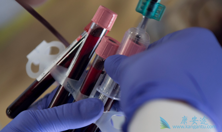 乙肝大三阳 乙肝大三阳