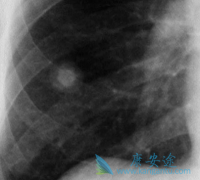 ���߳�����Щ�ΰ�����֢״ʱ�ΰ����κ���