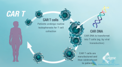 ŵ��CAR-Tϸ���Ʒ�KYMRIAH�ڶ�����Ӧ֢���FDA��׼